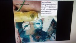 На Перинатальный центр Хабаровска возбудили ряд уголовных дел На Перинатальный центр Хабаровска возбудили ряд уголовных дел